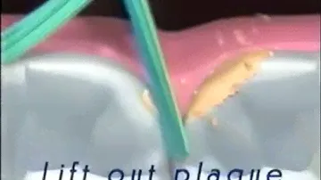 Oral-B (2001) Television Commercial